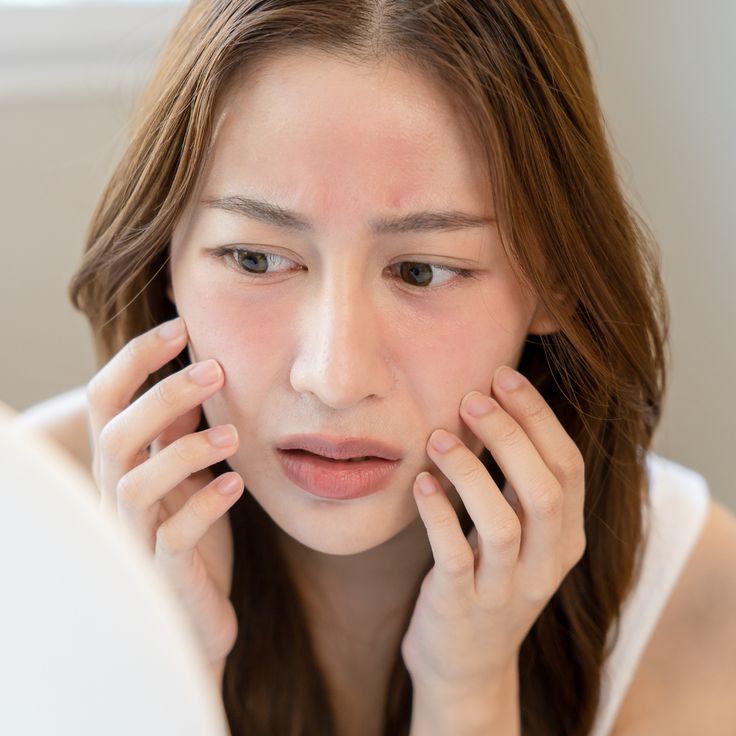 calm inflamed skin after sunburn