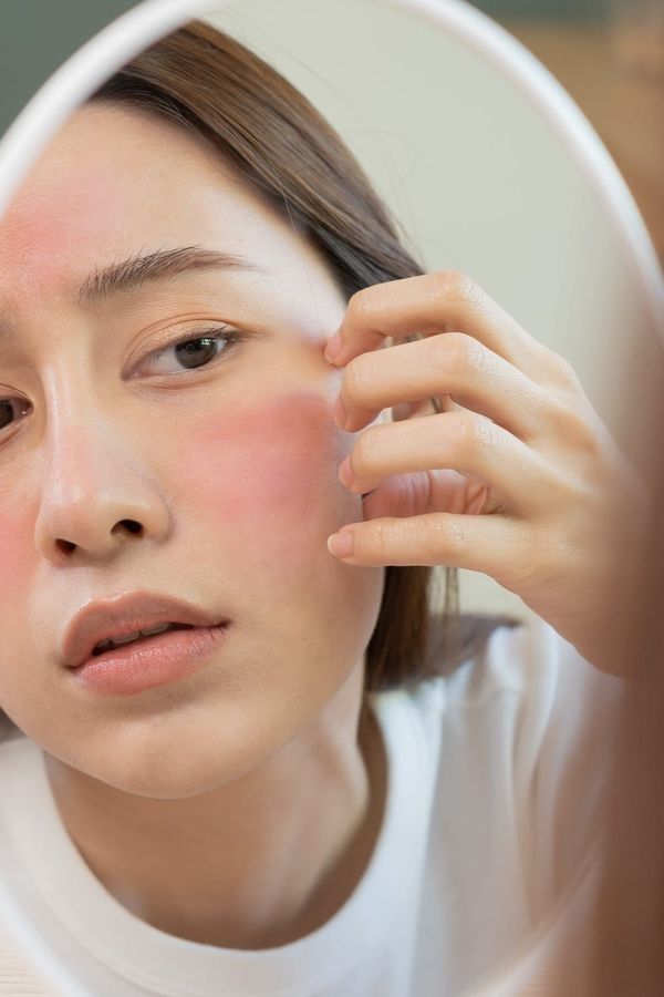 makeup for inflamed skin